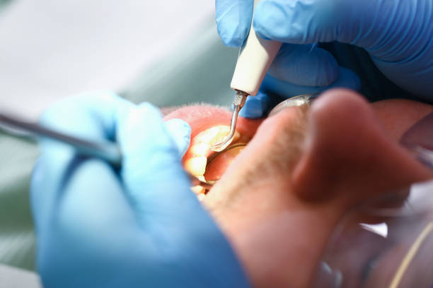Best Walk-In Emergency Dentist in West Burlington, IA