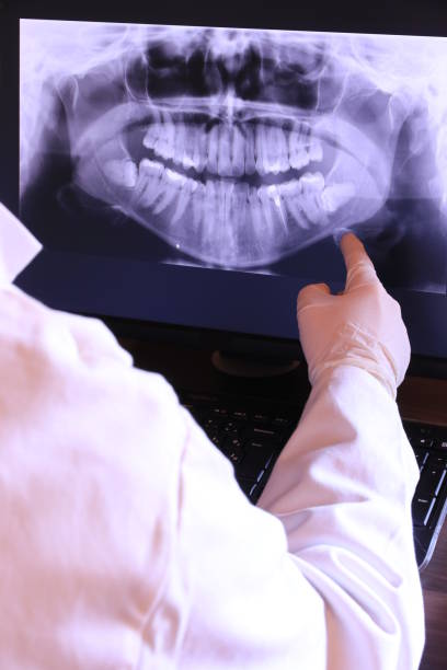 Best Same-Day Emergency Dentist in West Burlington, IA